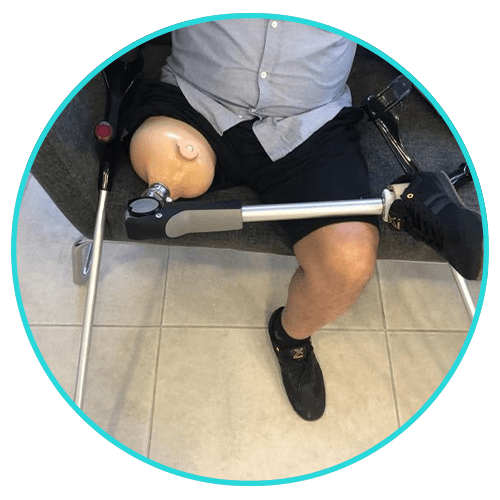 ساق اصطناعية فوق الركبة مع نظام هيدروليكي