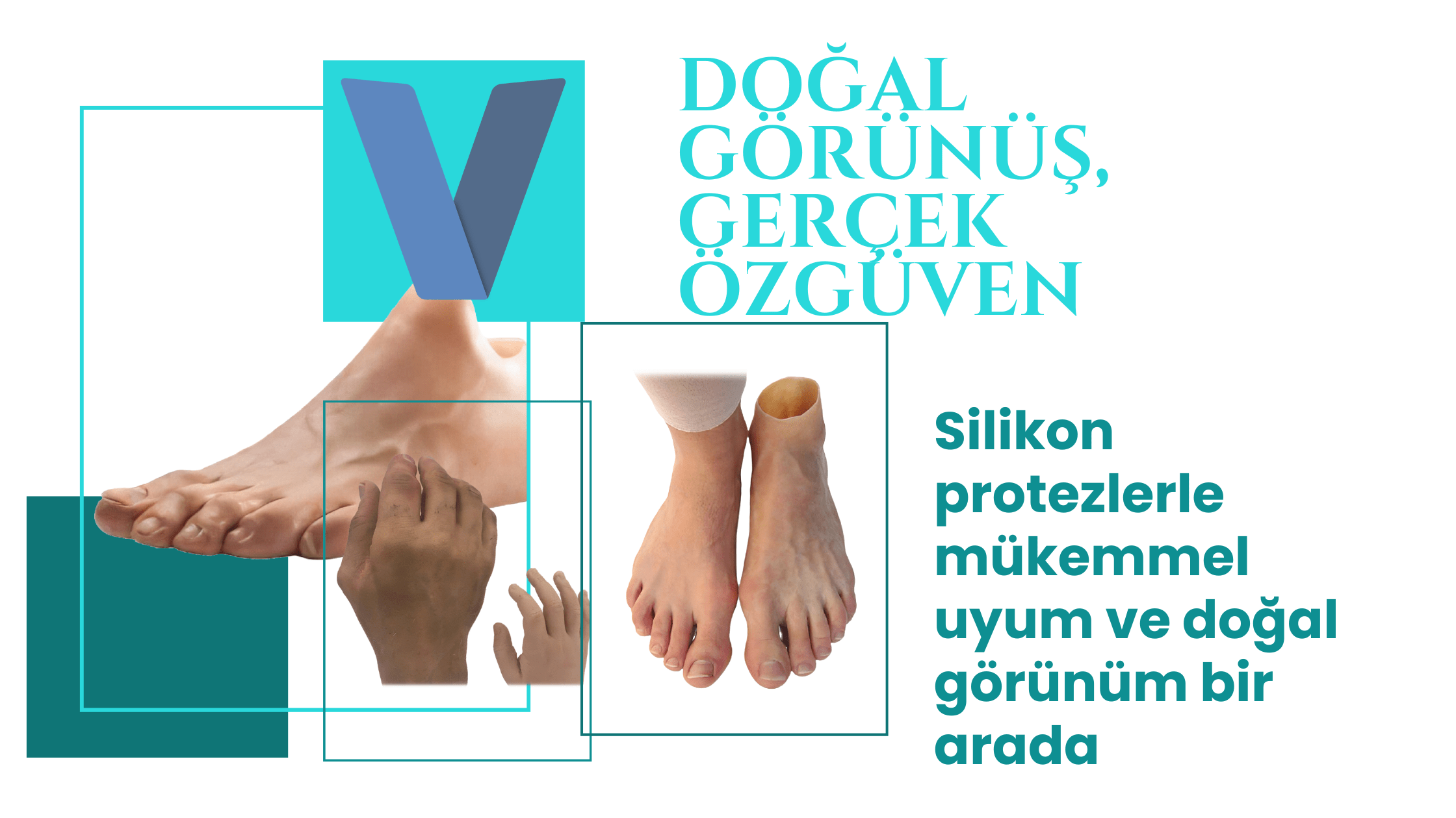 provitalprotez-silikon-protez.png