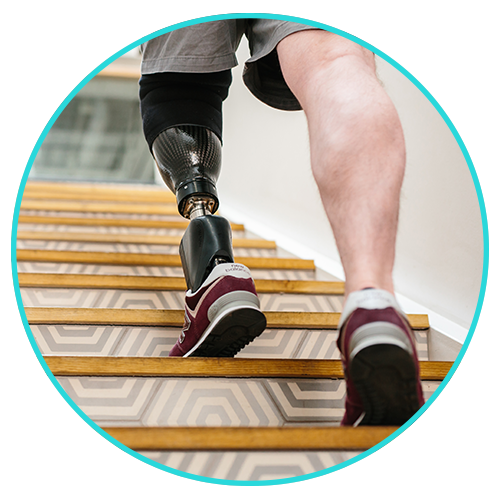 Prosthesis Prices and Types (2024) 1 provital prosthesis below knee prostheses