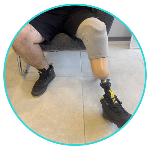 provital prosthesis ottobock below knee prosthetic leg