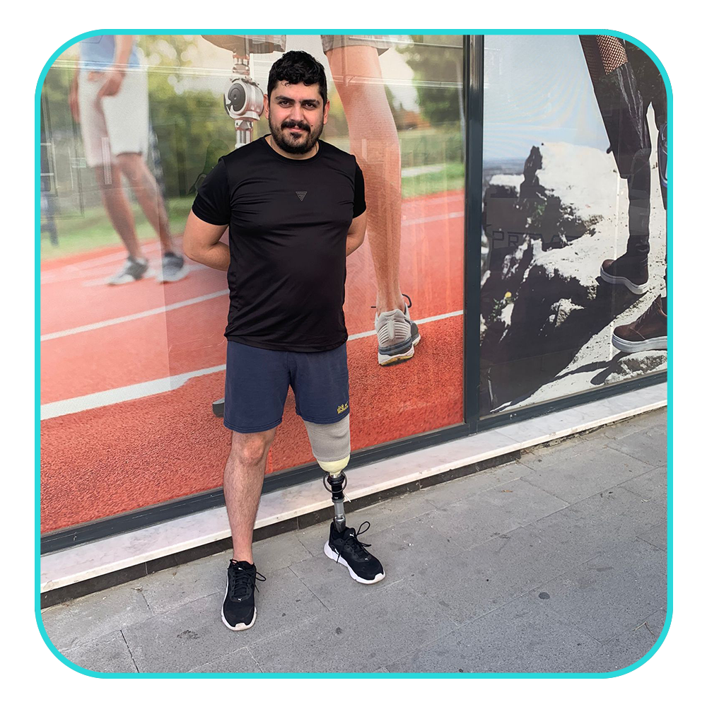 provital prostheses below knee ottobock harmony active vacuum prosthetic leg