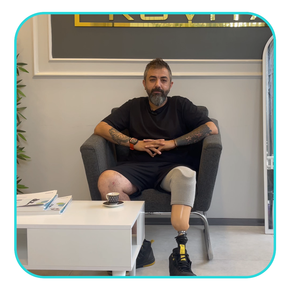 active vacuum prosthetic leg