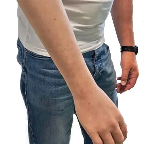 arm prosthetics
