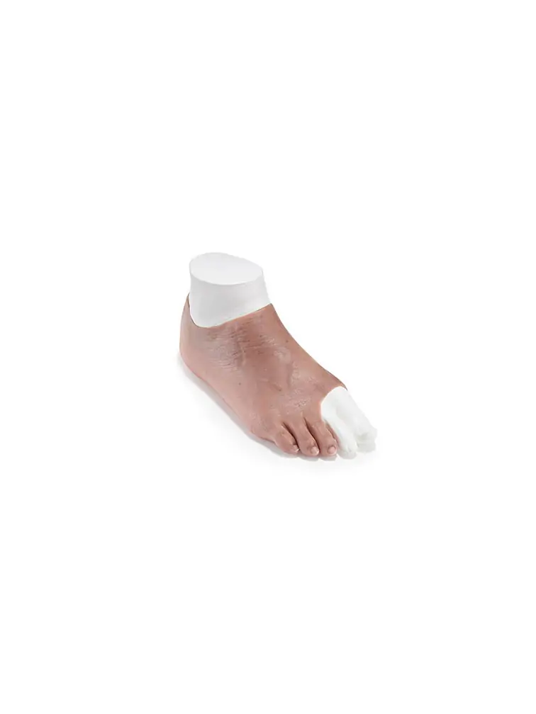 partial foot prosthesis