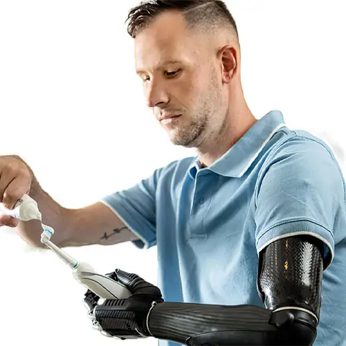 prosthetic arm