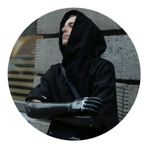 prosthetic robot arm