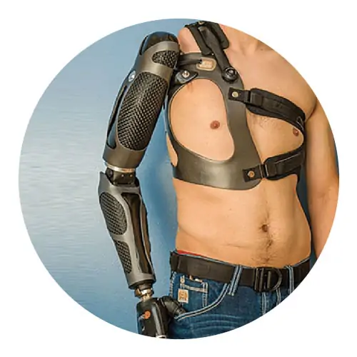 robotic arm prosthetic
