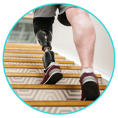 provitalprotez diz altı protez bacak