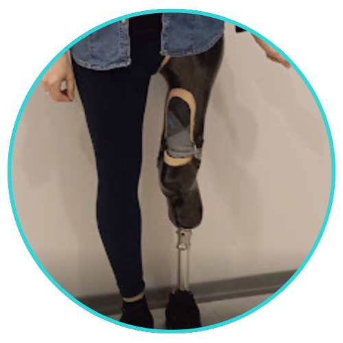 provitalprotez protez bacak