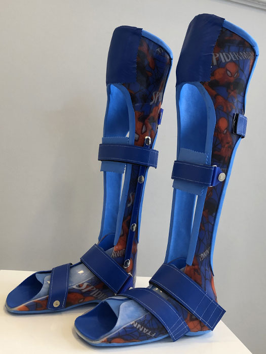 Grafo Ortez Nedir ve Neden Kullanılır? (2025 Fiyatları) 3 grafo-orthosis