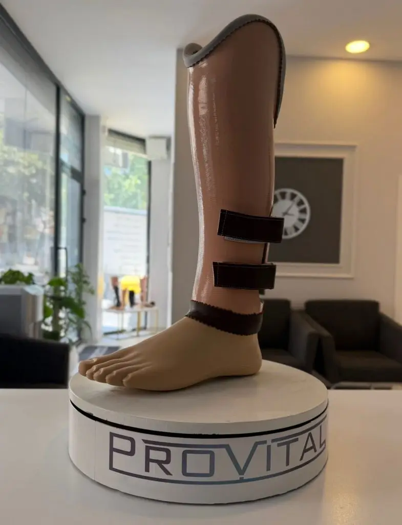 Syme Amputasyonu ve Protez Kullanımı 2 syme-protezi