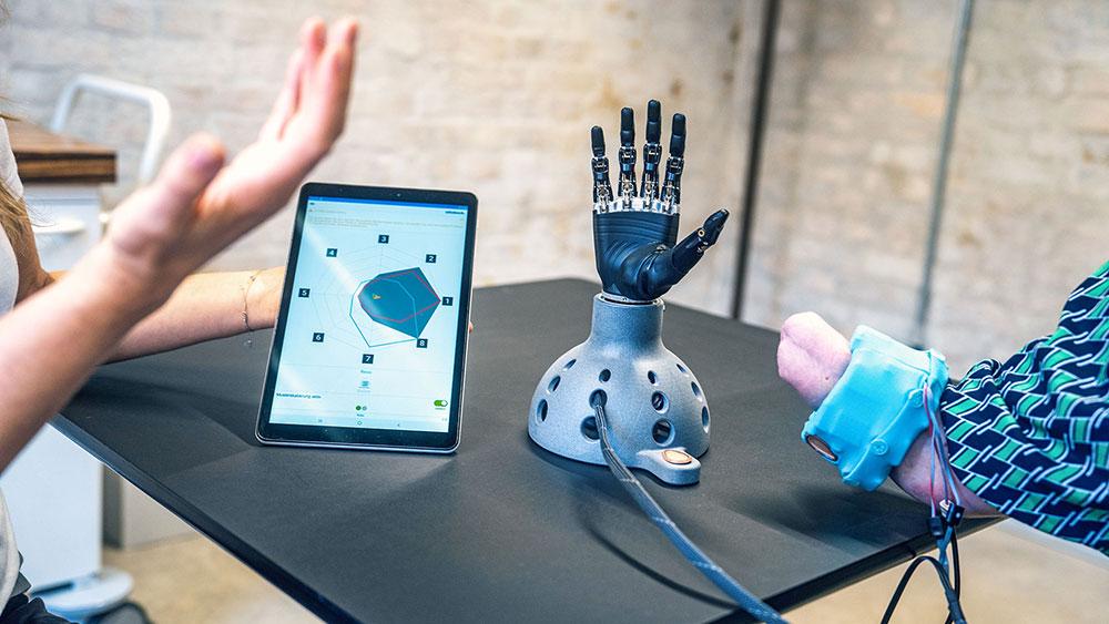 bebionic-prosthetic-hand