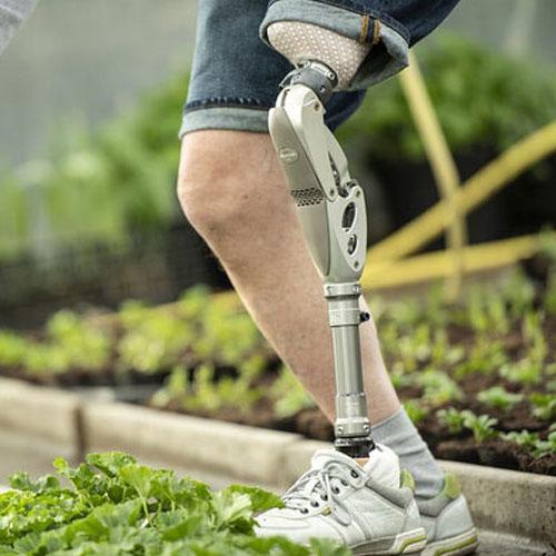 Blog 805 ottobock-3r60