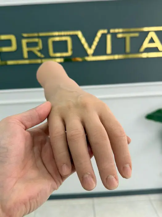 Silikon Protez Çeşitleri- El, Ayak, Parmak 38 silikon-parmak-protez-fiyatları